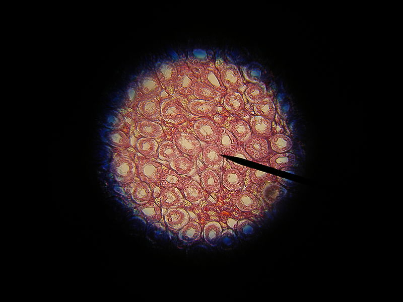 Microscope image shows epithelial tissue from a kidney. It has multiple rounded cells that are closely packed together.