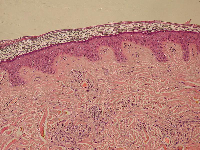 Microscope image of epithelial tissue from dermis and epidermis. There is a band of multiple layers of flattened cells. Below the band is a wavy layer with multiple small dark dots. Below that layers is an amorphous section with white squiggly lines throughout.