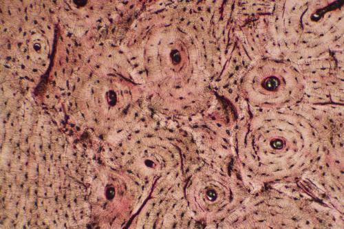 Microscope photo view of bone tissue, which has multiple sets of concentric circles with dark centers.